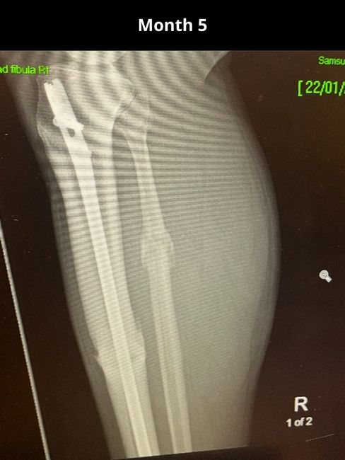 Month 1 (2)