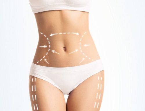 News: Body Contouring Market Set to Rise